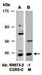 G Protein-Coupled Receptor 153 antibody, orb67184, Biorbyt, Western Blot image 
