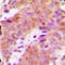 Ribosomal Protein S6 Kinase B1 antibody, LS-C352828, Lifespan Biosciences, Immunohistochemistry frozen image 