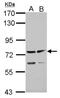 ADAM Metallopeptidase With Thrombospondin Type 1 Motif 5 antibody, NBP2-15286, Novus Biologicals, Western Blot image 