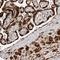 Alpha Kinase 2 antibody, NBP1-83296, Novus Biologicals, Immunohistochemistry paraffin image 