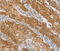 Centromere Protein E antibody, MBS2517076, MyBioSource, Immunohistochemistry paraffin image 