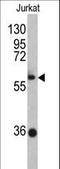 Zinc Finger And BTB Domain Containing 2 antibody, LS-C160720, Lifespan Biosciences, Western Blot image 
