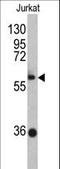 Zinc Finger And BTB Domain Containing 2 antibody, LS-C160720, Lifespan Biosciences, Western Blot image 