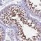 Zinc Finger Protein 317 antibody, NBP1-86220, Novus Biologicals, Immunohistochemistry frozen image 