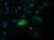 Follicle Stimulating Hormone Subunit Beta antibody, M01885-2, Boster Biological Technology, Immunofluorescence image 