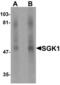 Serum/Glucocorticoid Regulated Kinase 1 antibody, LS-C144375, Lifespan Biosciences, Western Blot image 