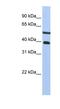 Phosphatase And Actin Regulator 3 antibody, NBP1-54364, Novus Biologicals, Western Blot image 