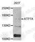 ATPase Copper Transporting Alpha antibody, A8399, ABclonal Technology, Western Blot image 