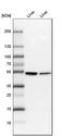 Cytochrome P450 Family 2 Subfamily E Member 1 antibody, HPA009128, Atlas Antibodies, Western Blot image 