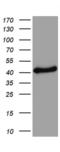 Tyrosinase antibody, LS-C797054, Lifespan Biosciences, Western Blot image 