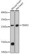 TIMP Metallopeptidase Inhibitor 2 antibody, 16-606, ProSci, Western Blot image 