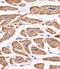 Makorin Ring Finger Protein 2 antibody, M10562, Boster Biological Technology, Immunohistochemistry paraffin image 