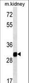 Glucosamine-6-Phosphate Deaminase 1 antibody, LS-C166567, Lifespan Biosciences, Western Blot image 