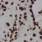 Myogenic Differentiation 1 antibody, FNab05511, FineTest, Immunohistochemistry paraffin image 