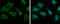 Citrate Synthase antibody, GTX628144, GeneTex, Immunocytochemistry image 