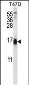 Spindle And Kinetochore Associated Complex Subunit 2 antibody, PA5-48419, Invitrogen Antibodies, Western Blot image 