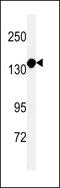 FANCD2 And FANCI Associated Nuclease 1 antibody, 61-855, ProSci, Western Blot image 