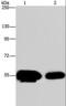 Amyloid Beta Precursor Protein Binding Family A Member 1 antibody, LS-C402891, Lifespan Biosciences, Western Blot image 