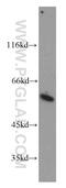 G Protein Pathway Suppressor 1 antibody, 11709-1-AP, Proteintech Group, Western Blot image 