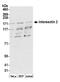 SH3P18-like WASP-associated protein antibody, NBP1-71833, Novus Biologicals, Western Blot image 