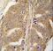 Paxillin antibody, LS-C99197, Lifespan Biosciences, Immunohistochemistry paraffin image 