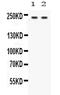 Otoferlin antibody, PA5-79776, Invitrogen Antibodies, Western Blot image 