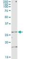 Testis Specific Serine Kinase 3 antibody, H00081629-M06, Novus Biologicals, Immunoprecipitation image 