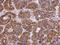 Complement Component 4 Binding Protein Beta antibody, GTX104277, GeneTex, Immunohistochemistry paraffin image 