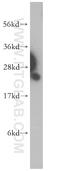 Proteasome Subunit Beta 1 antibody, 11749-1-AP, Proteintech Group, Western Blot image 