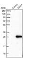 ER Membrane Protein Complex Subunit 7 antibody, NBP1-88547, Novus Biologicals, Western Blot image 