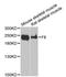 Coagulation Factor VIII antibody, STJ23600, St John