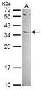 Mediator Complex Subunit 15 antibody, PA5-30227, Invitrogen Antibodies, Western Blot image 