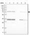 Lanosterol Synthase antibody, NBP2-33966, Novus Biologicals, Western Blot image 
