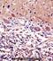 Cerebellar Degeneration Related Protein 2 antibody, abx028360, Abbexa, Immunohistochemistry paraffin image 