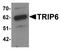 Thyroid Hormone Receptor Interactor 6 antibody, LS-C144321, Lifespan Biosciences, Western Blot image 