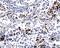 Interferon Induced Protein With Tetratricopeptide Repeats 5 antibody, orb315789, Biorbyt, Immunohistochemistry paraffin image 