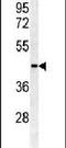 Sulfotransferase Family 2B Member 1 antibody, PA5-12244, Invitrogen Antibodies, Western Blot image 