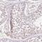 Tudor Domain Containing 15 antibody, HPA051770, Atlas Antibodies, Immunohistochemistry paraffin image 