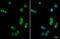 Spleen Associated Tyrosine Kinase antibody, GTX633910, GeneTex, Immunofluorescence image 