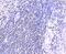 Checkpoint Kinase 2 antibody, NBP2-67595, Novus Biologicals, Immunohistochemistry paraffin image 