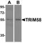 Tripartite Motif Containing 58 antibody, A14252, Boster Biological Technology, Western Blot image 