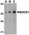 Suppressor Of Cytokine Signaling 1 antibody, PA5-20228, Invitrogen Antibodies, Western Blot image 