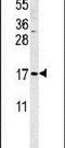 Small Cell Adhesion Glycoprotein antibody, PA5-25195, Invitrogen Antibodies, Western Blot image 