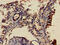 SHOC2 Leucine Rich Repeat Scaffold Protein antibody, CSB-PA891468LA01HU, Cusabio, Immunohistochemistry paraffin image 