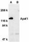 Apoptotic Peptidase Activating Factor 1 antibody, LS-C285, Lifespan Biosciences, Western Blot image 