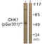 Checkpoint Kinase 1 antibody, LS-C198796, Lifespan Biosciences, Western Blot image 