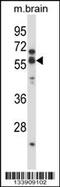 Cholinergic Receptor Nicotinic Alpha 5 Subunit antibody, 57-414, ProSci, Western Blot image 