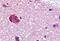 G Protein-Coupled Receptor 61 antibody, NB100-59013, Novus Biologicals, Immunohistochemistry frozen image 