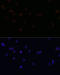 Integrin Subunit Beta 2 antibody, 18-552, ProSci, Immunofluorescence image 