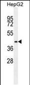 Proline Rich Transmembrane Protein 1 antibody, PA5-48145, Invitrogen Antibodies, Western Blot image 